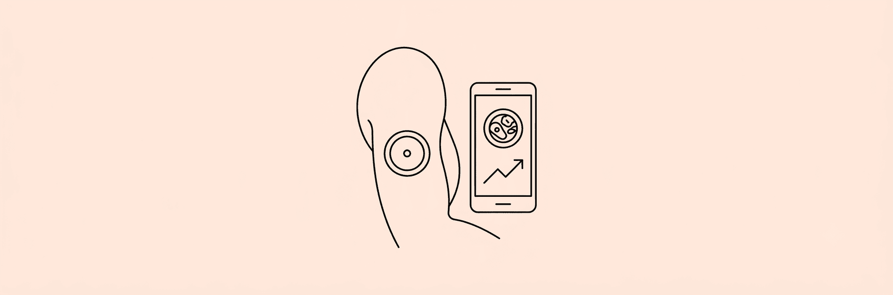 Line-art illustration of a continuous glucose monitor sensor patch and a smartphone showing a meal icon and a rising trend line